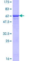 Human AKR7A2 / AFAR Protein (Recombinant GST)