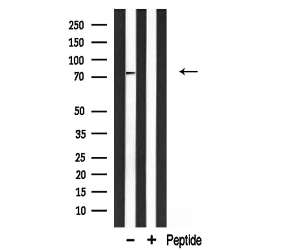 GIT2 Antibody
