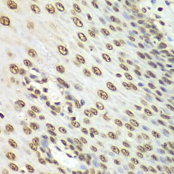 Polyclonal Rabbit anti-Human NONO / P54NRB Antibody (IHC, IF, WB)