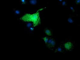 SULT1A1 / Sulfotransferase 1A1 Antibody (clone OTI9D10)