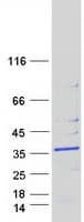 Human MRPS18B Protein (Recombinant Myc-DDK (Flag))
