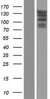 STK10 / LOK Protein (Over-Expression Lysate Myc-DDK (Flag))