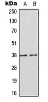 Polyclonal Rabbit anti-Human SOCS1 Antibody (Internal, IF, WB)