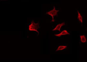 MMP8 Antibody