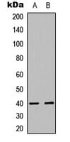 Polyclonal Rabbit anti-Human ISL2 / Islet 2 Antibody (Internal, IF, WB)