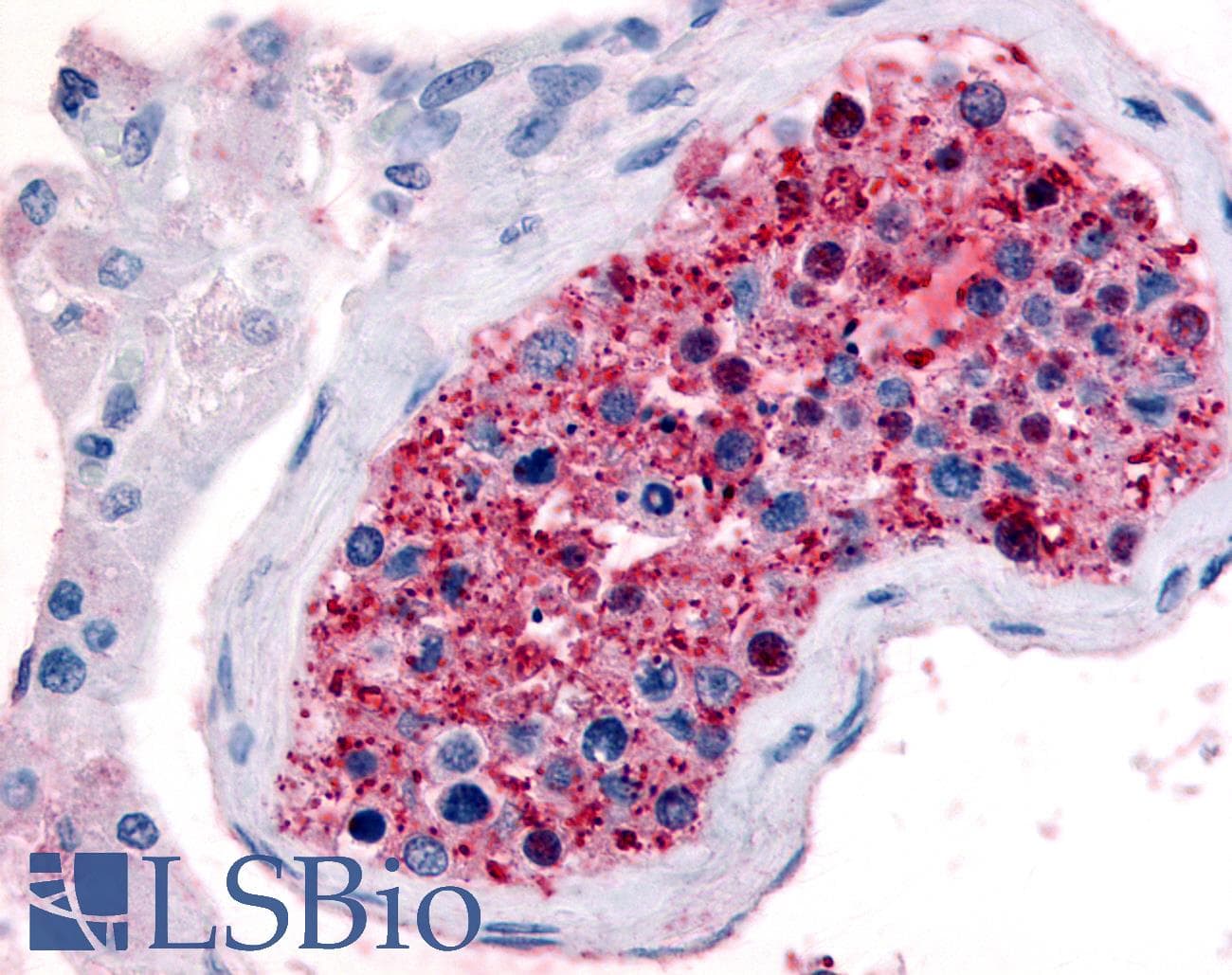 IHC-plus™ FZD9 / Frizzled 9 Antibody (N-Terminus)