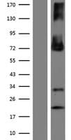 Human ENTPD4 / LALP70 Protein (Over-Expression Lysate Myc-DDK (Flag))