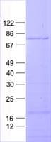 Human RIOK2 Protein (Recombinant His, N-Terminal)