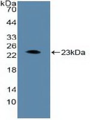 ARNT / HIF-1-Beta Antibody (aa624-789)