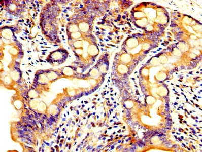 PC5 / PCSK5 Antibody