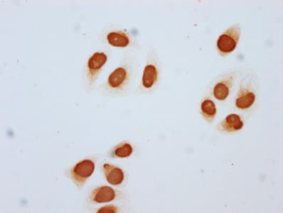 HIST1H2BN Antibody