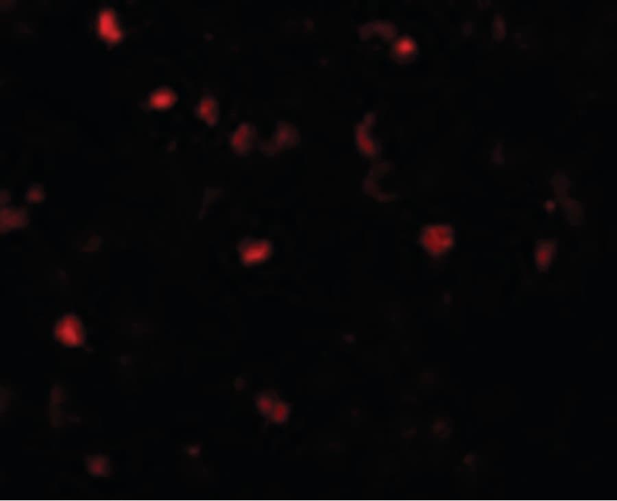 Polyclonal Rabbit anti-Human TMEM16B / ANO2 Antibody (IHC, IF, WB)