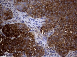 NME1 / NM23 Antibody (clone OTI22F10)
