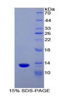 Human XCL1 / Lymphotactin Protein (Recombinant His-T7)