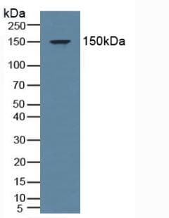 Mineralocorticoid Receptor Antibody (aa739-984, Biotin)