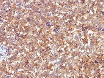 Alpha-Fetoprotein Antibody (clone C2, Ready-to-Use)