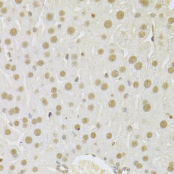 SFN / Stratifin / 14-3-3 Sigma Antibody