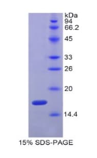 Human C25H / CH25H Protein (Recombinant His, N-Terminal)