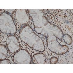 Monoclonal Mouse anti-Human MMP1 Antibody (clone 3B6, C-Terminus, IHC, WB)