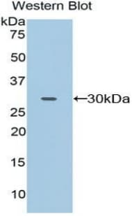 CD32A Antibody (aa69-309, Cy3)