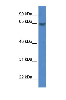 CAMK2B / CaMKII Beta Antibody (C-Terminus)