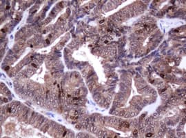 Monoclonal Mouse anti-Human MKI67 / Ki67 Antibody (clone OTI8H5, IHC)