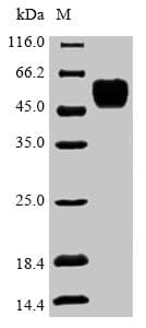 Zebrafish COPS2 / TRIP15 / ALIEN Protein (Recombinant 6His, N-terminus)
