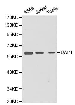 Polyclonal Rabbit anti-Human UAP1 Antibody (IHC, WB)
