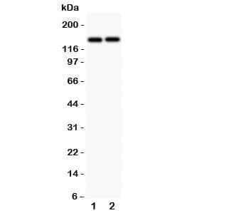 Polyclonal Rabbit anti-Human Collagen III Antibody (aa897-918, WB)