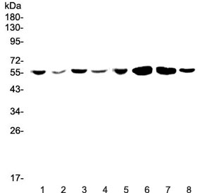 Polyclonal Rabbit anti-Human CCR3 Antibody (WB)