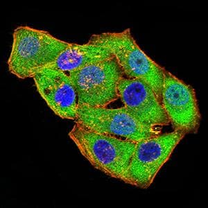 GRIK4 / KA1 Antibody (clone 8H5H9)
