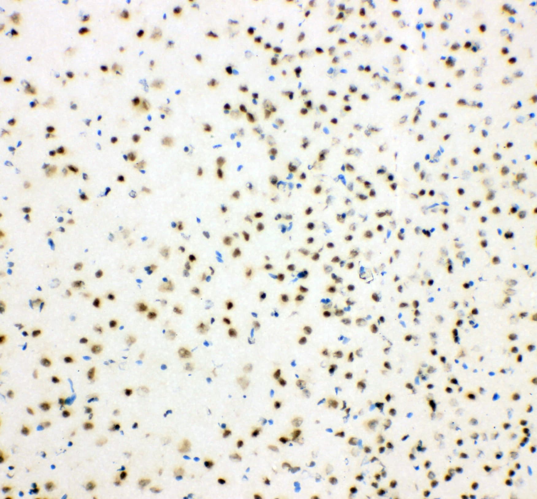 Polyclonal Rabbit anti-Human HDAC3 Antibody (aa1-18, IHC, WB)