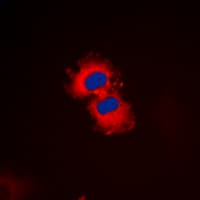 ZAK / MLTK Antibody (C-Terminus)