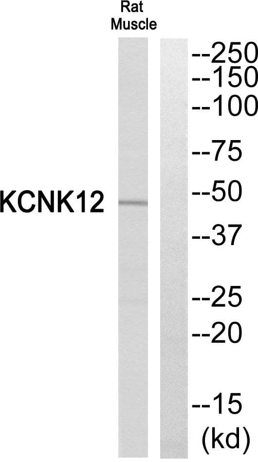 KCNK12 Antibody