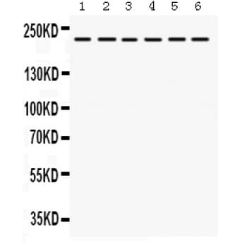 ITGA4 / VLA-4 / CD49d Antibody (aa999-1028)