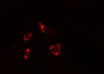 Polyclonal Rabbit anti-Human SNCB / Beta-Synuclein Antibody (IHC, IF, WB)