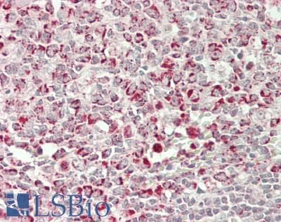 IHC-plus™ DENN / MADD Antibody (aa1597-1647)