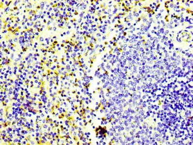 Recombinant Monoclonal Rabbit anti-Human CD163 Antibody (IHC)