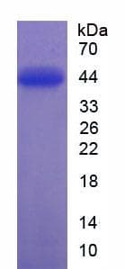 Human AKT1 Protein (Recombinant His-T7)