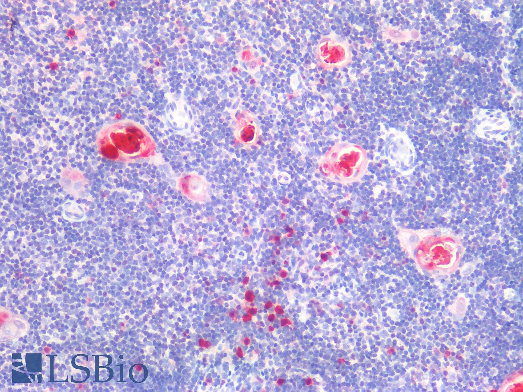 PathPlus™ Monoclonal Mouse anti-Human S100A8 / MRP8 Antibody (clone MAC 387, Azide-free, IHC)