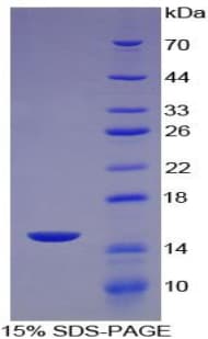 Human CCL8 / MCP2 Protein (Recombinant His-T7)