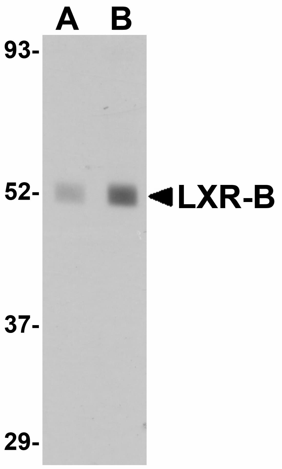 NR1H2 / LXR Beta Antibody