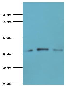 Polyclonal Rabbit anti-Human CAPG Antibody (aa1-348, WB)