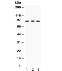 Polyclonal Rabbit anti-Human KAT2A / GCN5 Antibody (WB)