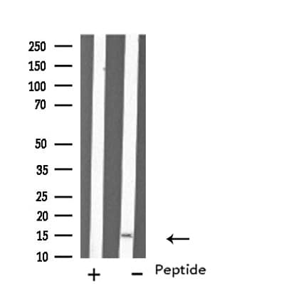 MYL6 Antibody