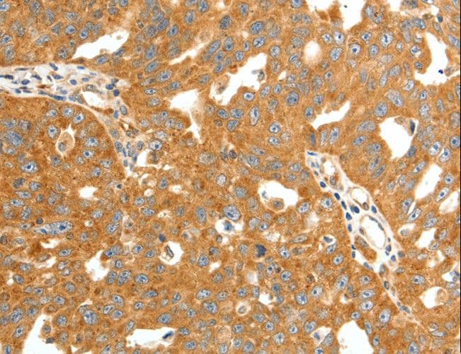 Secretin Antibody