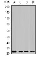 Polyclonal Rabbit anti-Human CFAP20 / GTL3 Antibody (IF, WB)