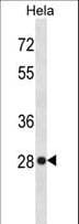 Polyclonal Rabbit anti-Human HMG1 / HMGB1 Antibody (aa152-180, WB)