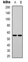 Polyclonal Rabbit anti-Human POLM / DNA Polymerase Mu Antibody (Internal, WB)