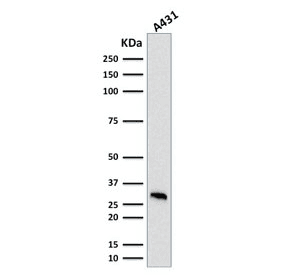 MTAP Antibody (clone MTAP/1813)